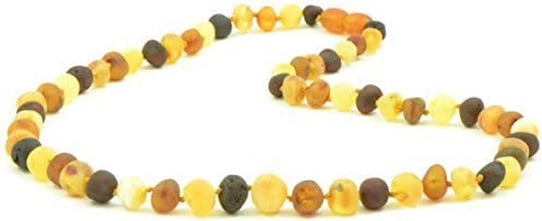 Raw Baltic Amber Necklace – Handmade Cognac, Cherry, Lemon &amp; Multi-Color Baroque Beads for Adults